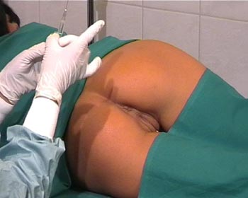 Injection in female butt porno