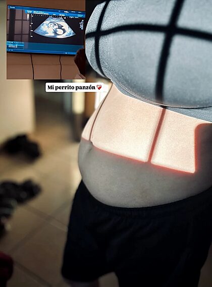 CXMILX_BALUT nude photo #60