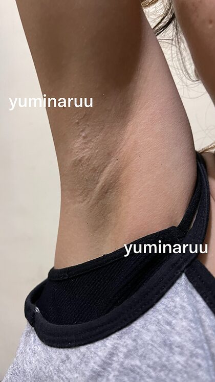Yuminaruu nude photo #3