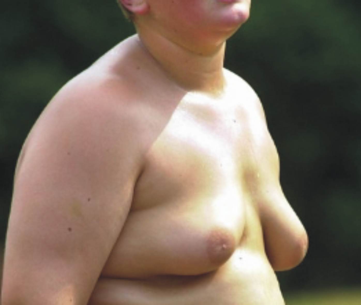 некрасивая грудь у мужчин фото 101