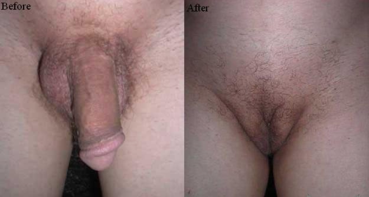 Male Sex Change Porn - Sex change after photos | TubeZZZ Porn Photos