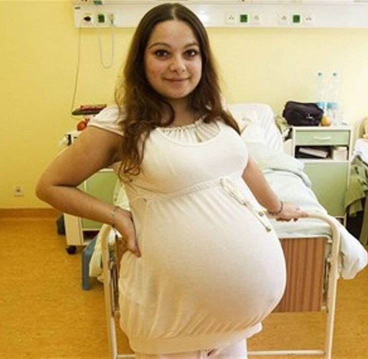 Pregnant With Sextuplets Belly - Sextuplet pregnant | TubeZZZ Porn Photos
