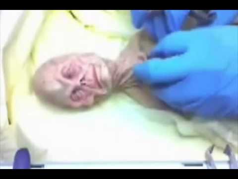 Male penis implant-xxx video hot porn