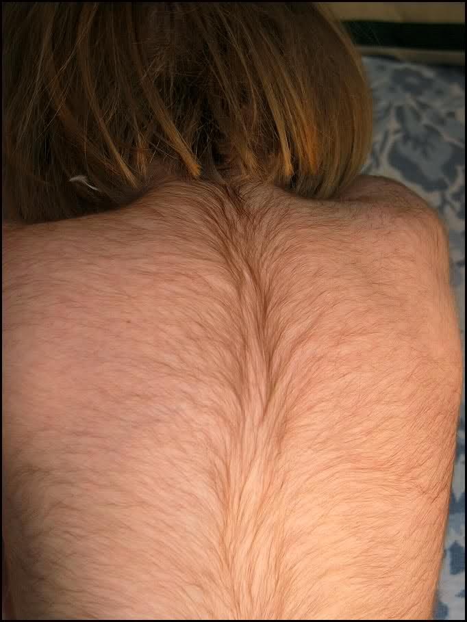 Hairy Back Pics TubeZZZ Porn Photos