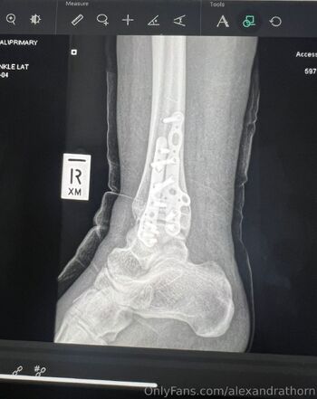 Alex Sa / alexandrathorn / missalexthorn / dildodorothy nude photo #48