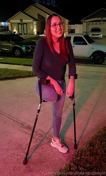 Amputee Yar / ampgirl.free nude photo #3