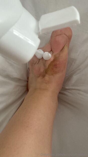 Lul / amputationlula nude photo #6