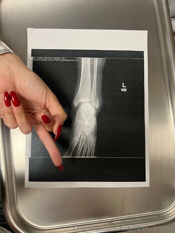 Angel Baby Ameli / angelbabyamelie nude photo #3