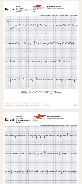 Anik / anika_ssbbw nude photo #30