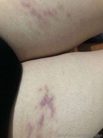 𝖇𝖑𝖔𝖔𝖉𝖞 / dasshitee nude photo #14