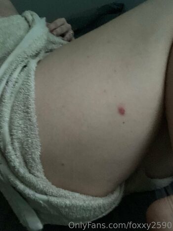 Lil Red fox fre / foxxy2590 / london_foxy90 / naughtywild8163 nude photo #19