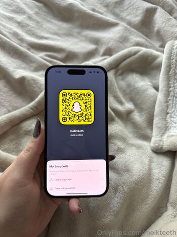 summe / melkteeth / melk.teeth / melkteeth1 nude photo #7